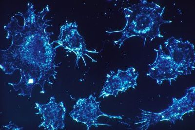 https://www.funerariadeguardia.es/almacen/noticias/img_cancercells5419541280.jpg
